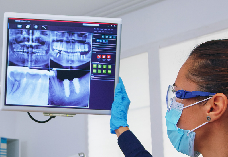 Implantologia a Carico Immediato