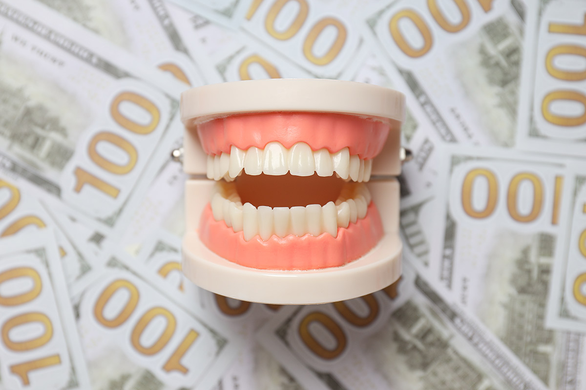 Quanto costa un impianto dentale? Guida ai prezzi