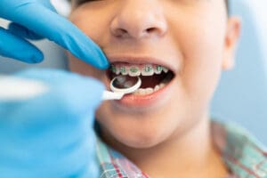 quanto costa un apparecchio per i denti prezzi e soluzioni
