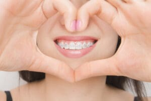 quanto costa un apparecchio per i denti prezzi e soluzioni