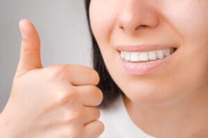 apparecchio invisibile denti costi invisalign e alternative