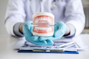 impianti dentali sono mutuabili ssn asl e requisiti