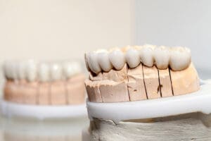 corone dentali cosa sono quando servono e quanto costano