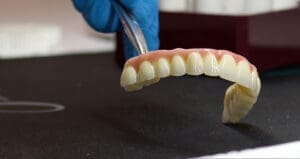 quanto costa una dentiera prezzi differenze e soluzioni