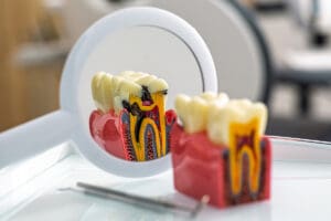 ascesso dentale sintomi cosa fare e quando e urgente